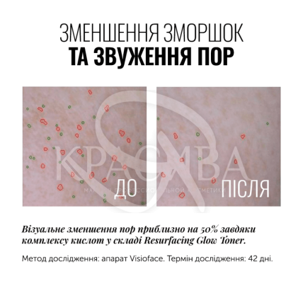 Кислотний тонер - 3