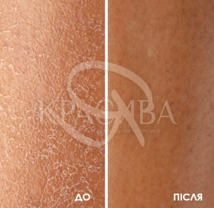 Натуральний батер для інтенсивного зволоження та захисту шкіри - 3