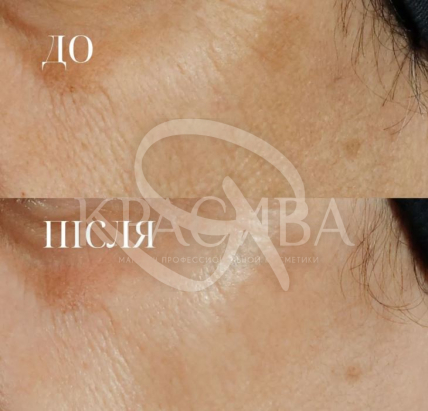 Омолаживающая сыворотка с ретинолом - 3