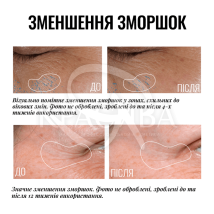 Крем навколо очей - 3