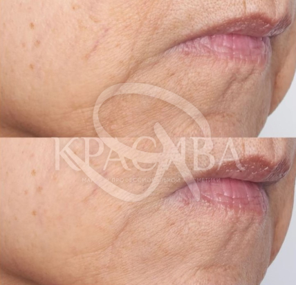 Охолоджувальна гелева маска забезпечує миттєвий заряд потужного зволоження - 4