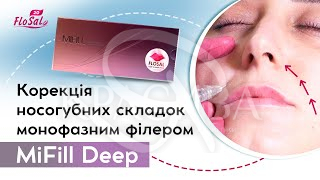 Монофазный филлер средней плотности - 2