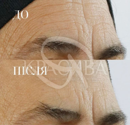 Омолаживающая сыворотка с ретинолом - 2