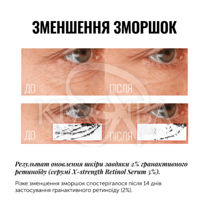 Сироватка з ретиноїдом - 3
