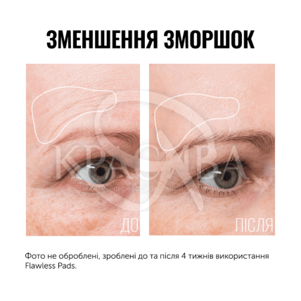 Пілінг - диски для обличчя - 3