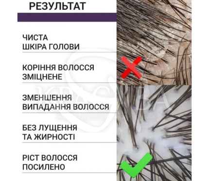 Скраб для кожи головы с кератином - 3
