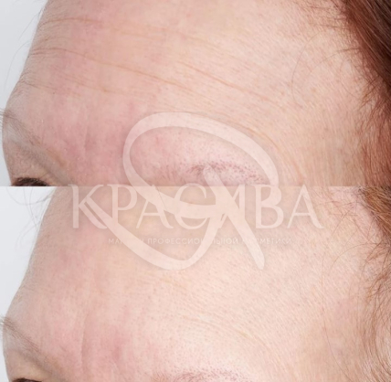 Маска для обличчя миттєвого живлення та зволоження - 3