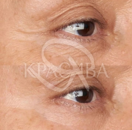 Заспокійливий крем навколо очей для чутливої шкіри - 3