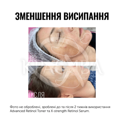 Тонер з ретинолом - 3
